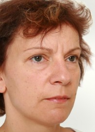 viksraitis